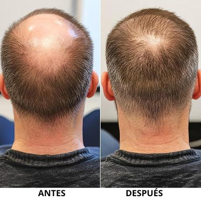 SHAMPOO EXCALVO - CON FORMULA NATURAL PARA REDUCIR CAÍDA Y AUMENTAR CRECIMIENTO